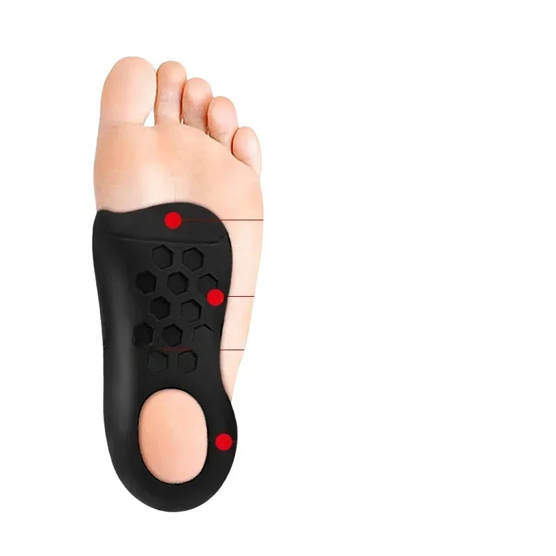 1 Pair Orthotic Insoles For Flat Feet O-Shaped Legs And Plantar